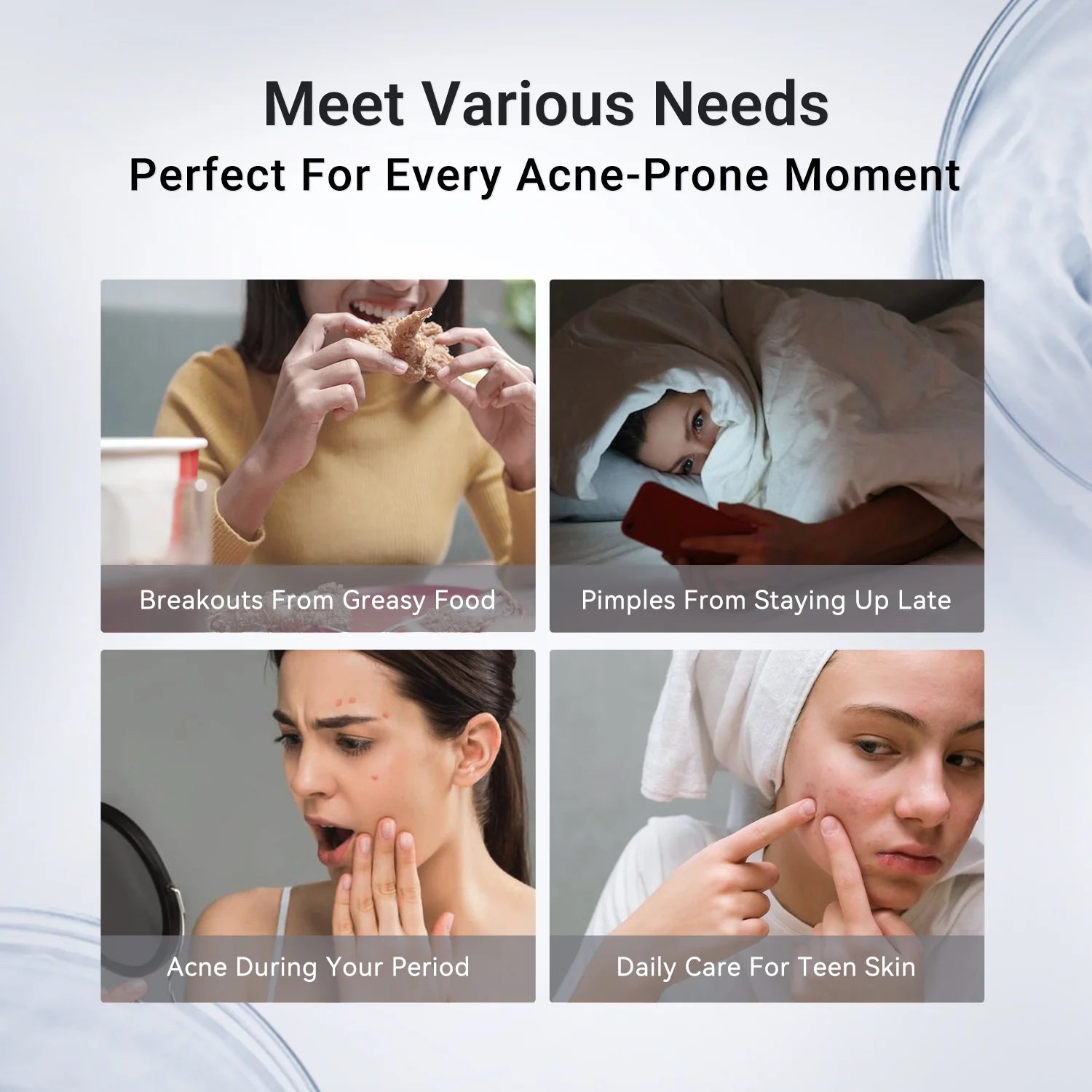 Acne Drying Lotion
