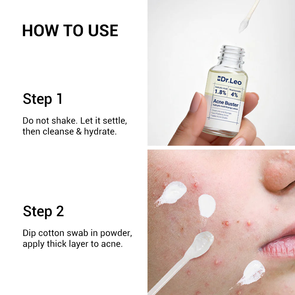 Acne Drying Lotion
