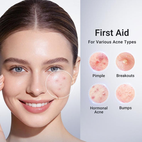 Acne Drying Lotion Plus